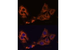 Immunofluorescence analysis of C6 cells using SM antibody (ABIN7270612) at dilution of 1:100. (SMAP1 Antikörper  (AA 180-250))