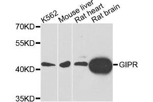 Western blot analysis of extracts of various cell lines, using GIPR antibody.