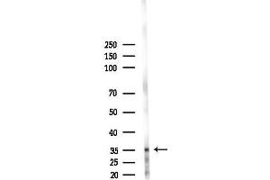 anti-Mucolipin 1 (MCOLN1) antibody