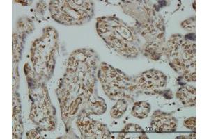 Image no. 1 for anti-Non-SMC Condensin I Complex, Subunit D2 (NCAPD2) (AA 1240-1339) antibody (ABIN599100) (NCAPD2 Antikörper  (AA 1240-1339))