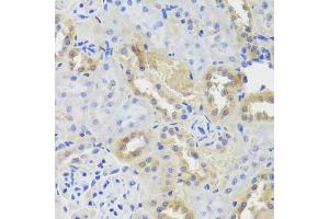 Immunohistochemistry of paraffin-embedded rat kidney using CTSC antibody (ABIN5974676) at dilution of 1/100 (40x lens). (CTSC Antikörper)