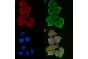 ABIN6262142 and ABIN6272316 staining Hela cells(30 min of UV treatment) by IF/ICC. (HABP2 Antikörper  (Internal Region))