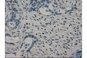 Image no. 5 for anti-Crystallin, alpha B (CRYAB) antibody (ABIN1497645) (CRYAB Antikörper)