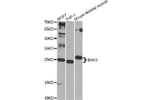 Western blot analysis of extracts of various cell lines, using BAK1 Antibody (ABIN6291814) at 1:1000 dilution. (BAK1 Antikörper)