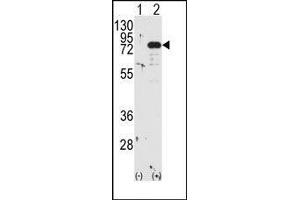 Western blot analysis of PRKCB (arrow) using PKC beta1/2 Antibody