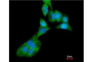 Immunofluorescence (IF) image for anti-Matrix Metallopeptidase 3 (Stromelysin 1, Progelatinase) (MMP3) (Ser373) antibody (ABIN615526)