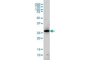 GCH1 monoclonal antibody (M01), clone 4A12 Western Blot analysis of GCH1 expression in IMR-32 . (GCH1 Antikörper  (AA 84-172))