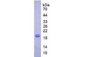 SDS-PAGE analysis of Human IL18BP Protein. (IL18BP Protein)