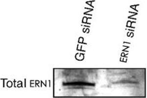Western blot analysis of ERN1 alpha in transfected min6 cells using ERN1 polyclonal antibody . (ERN1 Antikörper  (AA 700-800))