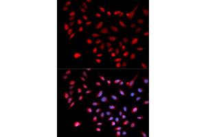 Immunofluorescence analysis of U2OS cell using CDK9 antibody. (CDK9 Antikörper  (AA 153-372))
