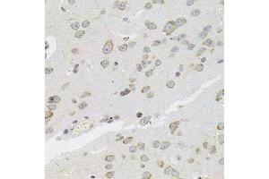 Immunohistochemistry of paraffin-embedded mouse brain using VEPH1 antibody (ABIN5974616) (40x lens). (VEPH1 Antikörper)