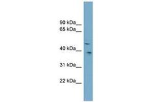 Image no. 1 for anti-Sparc/osteonectin, Cwcv and Kazal-Like Domains Proteoglycan (Testican) 3 (SPOCK3) (AA 359-408) antibody (ABIN6743341) (SPOCK3 Antikörper  (AA 359-408))