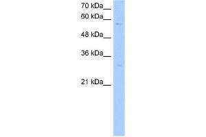 WB Suggested Anti-STEAP4 Antibody Titration:  0. (STEAP4 Antikörper  (C-Term))