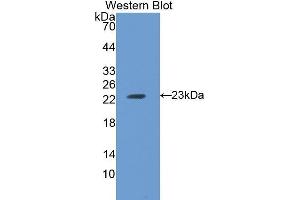 Western Blotting (WB) image for anti-Ferritin, Heavy Polypeptide 1 (FTH1) (AA 1-182) antibody (ABIN1078027) (FTH1 Antikörper  (AA 1-182))