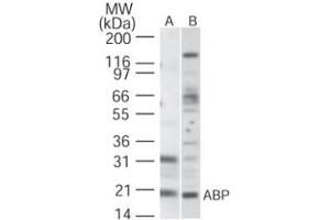 Image no. 1 for anti-Kv Channel Interacting Protein 1 (KCNIP1) (AA 11-28) antibody (ABIN208269) (KCNIP1 Antikörper  (AA 11-28))