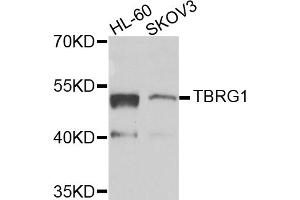 Western blot analysis of extracts of various cell lines, using TBRG1 antibody (ABIN5975095) at 1/1000 dilution. (TBRG1 Antikörper)