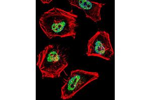 Fluorescent confocal image of Hela cell stained with (MOUSE) Ncor1 Antibody.