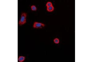 Immunofluorescent analysis of MC5 Receptor staining in MCF7 cells.