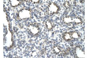 Rabbit Anti-JUN Antibody       Paraffin Embedded Tissue:  Human alveolar cell   Cellular Data:  Epithelial cells of renal tubule  Antibody Concentration:   4. (C-JUN Antikörper  (N-Term))