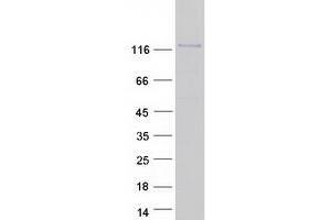 Western Blotting (WB) image for Contactin 1 (CNTN1) (Transcript Variant 2) protein (Myc-DYKDDDDK Tag) (ABIN2712477)