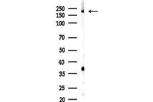 Western blot analysis of lysates from K562 cells(heat-shock 45 min treatment), using ARFGEF1 Antibody at 1/1000 dilution.