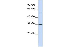 NEK3 antibody used at 1 ug/ml to detect target protein. (NEK3 Antikörper)