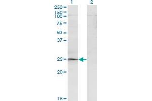 Western Blotting (WB) image for anti-TGFB-Induced Factor Homeobox 2 (TGIF2) (AA 1-238) antibody (ABIN961323)