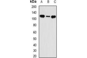 Western blot analysis of INTS5 expression in MCF7 (A), HT29 (B), mouse liver (C) whole cell lysates.