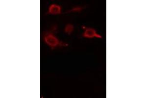 ABIN6275499 staining  RAW264. (ARHGEF5 Antikörper  (Internal Region))