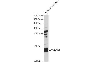 Western blot analysis of extracts of mouse pancreas, using TYROBP antibody (ABIN7271115) at 1:3000 dilution.