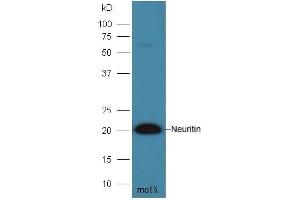 Mouse brain lysates probed with Anti- Neuritin Polyclonal Antibody, Unconjugated  at 1:300 overnight at 4˚C.