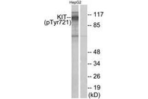 Western Blotting (WB) image for anti-Mast/stem Cell Growth Factor Receptor (KIT) (pTyr721) antibody (ABIN2888461) (KIT Antikörper  (pTyr721))