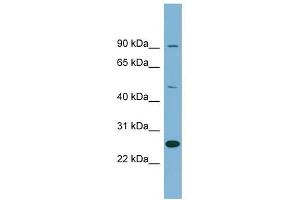 LRRC49 antibody used at 1 ug/ml to detect target protein. (LRRC49 Antikörper  (N-Term))