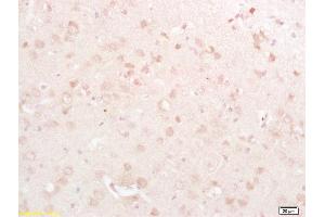 Formalin-fixed and paraffin embedded rat brain labeled with Rabbit Anti DRP1/DNM1L Polyclonal Antibody, Unconjugated  at 1:200 followed by conjugation to the secondary antibody and DAB staining