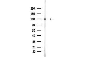 Western blot analysis of lysates from Raji cells(heat-shock,45 min treatment), using STT3A Antibody at 1/1000 dilution.