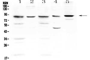 Western blot analysis of NADPH oxidase 4 using anti-NADPH oxidase 4 antibody . (NADPH Oxidase 4 Antikörper)