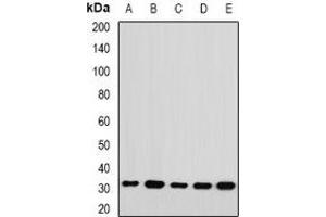Western blot analysis of RPL14 expression in Jurkat (A), HepG2 (B), mouse spleen (C), mouse ovary (D), rat kidney (E) whole cell lysates.