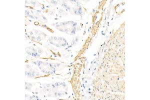 Immunohistochemistry of paraffin-embedded rat kidney using Caspase-7 Rabbit pAb (ABIN3022071, ABIN3022072, ABIN3022073 and ABIN6218596) at dilution of 1:150 (40x lens). (Caspase 7 Antikörper  (AA 24-303))