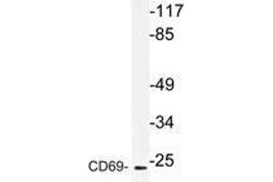 Western blot (WB) analysis of CD69 antibody in extracts from HUVEC cells. (CD69 Antikörper)