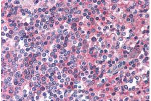Anti-EMR2 antibody  ABIN1048546 IHC staining of human spleen. (EMR2 Antikörper  (N-Term))