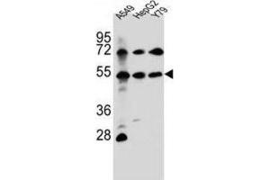 Western Blotting (WB) image for anti-Fibroblast Growth Factor Receptor-Like 1 (FGFRL1) antibody (ABIN2996911) (FGFRL1 Antikörper)