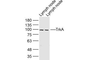 Lane 1: mouse lymph node lysates Lane 2: rat Lymph node lysates probed with TrkA Polyclonal Antibody, Unconjugated  at 1:300 dilution and 4˚C overnight incubation. (TRKA Antikörper  (AA 725-821))