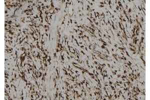 ABIN6272973 at 1/100 staining Human gastric tissue by IHC-P. (PBXIP1 Antikörper  (C-Term))