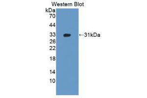 Western blot analysis of the recombinant protein. (ADAM12 Antikörper  (AA 513-767))