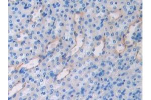Immunohistochemistry (IHC) image for anti-Fibulin 4 (FBLN4) (AA 182-431) antibody (ABIN7437848)