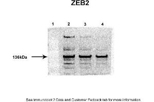 Sample Type: 1. (ZEB2 Antikörper  (Middle Region))