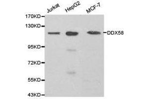 Western Blotting (WB) image for anti-DEAD (Asp-Glu-Ala-Asp) Box Polypeptide 58 (DDX58) antibody (ABIN1872240)