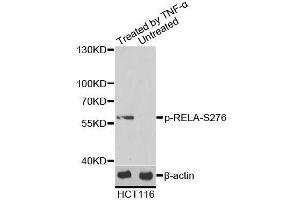 Western blot analysis of extracts of HCT116 cells, using Phospho-RELA-S276 antibody (ABIN6003884). (NF-kB p65 Antikörper  (pSer276))