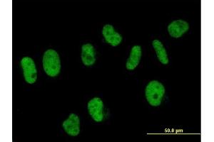 Immunofluorescence of purified MaxPab antibody to SART3 on HeLa cell.