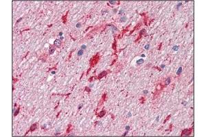 Immunohistochemistry (IHC) image for anti-Hepatocyte Growth Factor (Hepapoietin A, Scatter Factor) (HGF) antibody (ABIN492557) (HGF Antikörper)